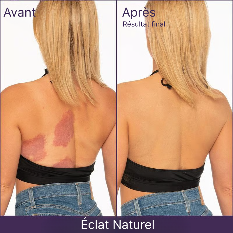 🎁Dernier jour de promotion ✨ - Perfecteur de teint complet