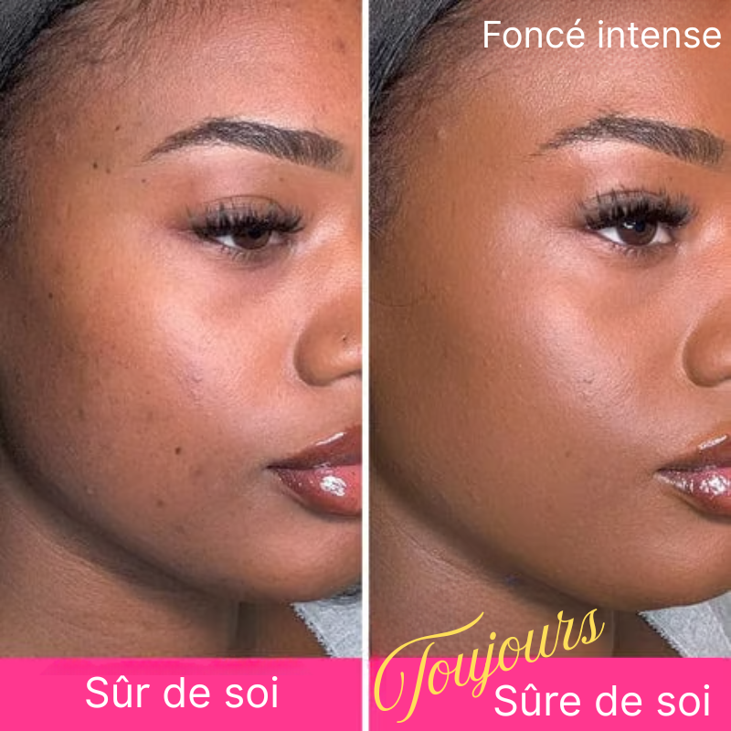 🌸✨ Perfecteur Teint & Soin – 🌞 Promotion d’Été ✨